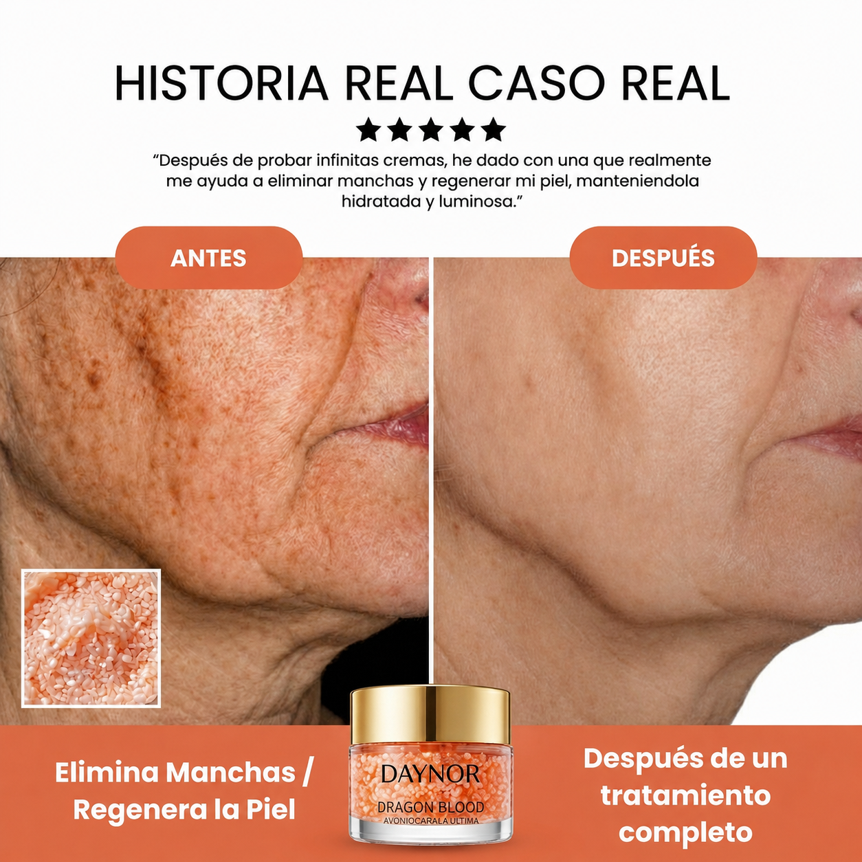 Sangre de Dragon Retinol Crema Anti edad - DAYNOR  ¡1 + 1 GRATIS!
